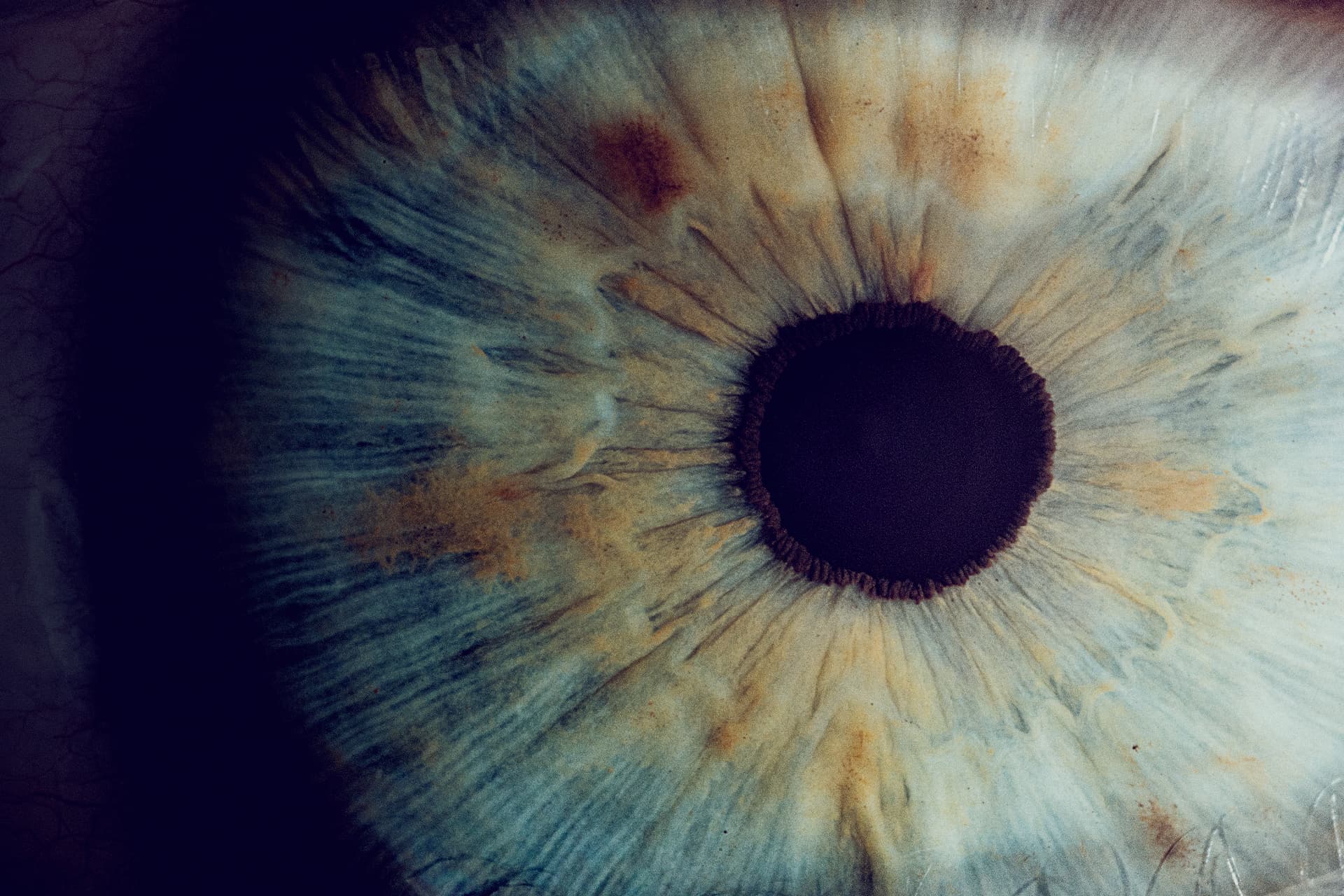 Eye